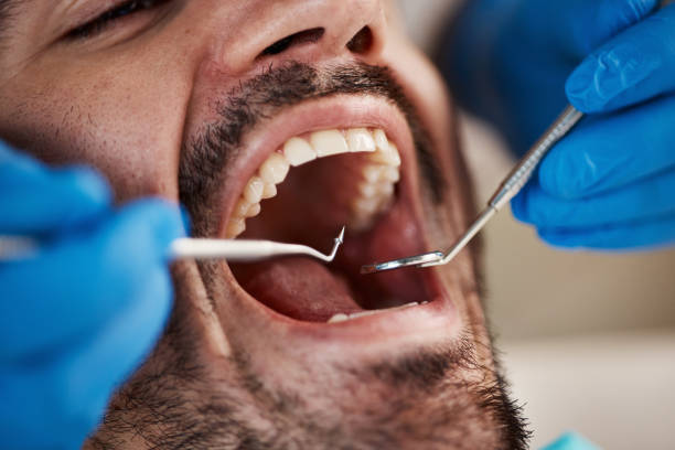 Best Root Canal Treatment  in Hamilton City, CA